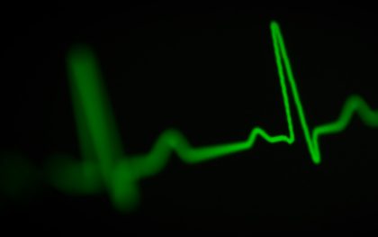An ECG built from discrete components
