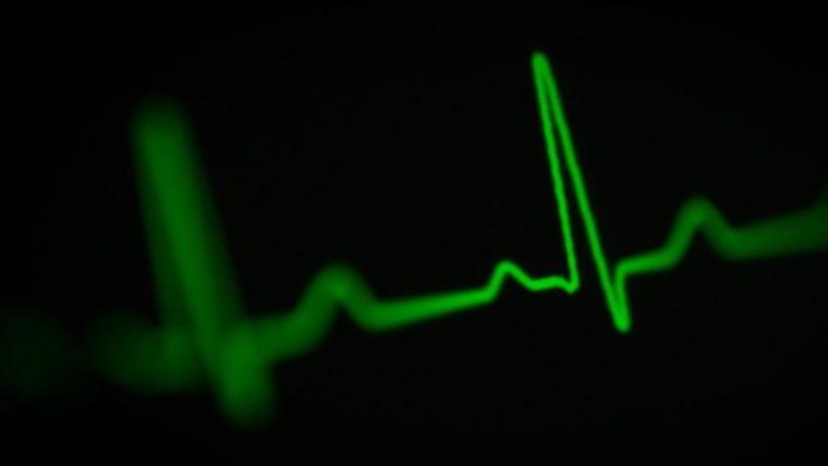 An ECG built from discrete components