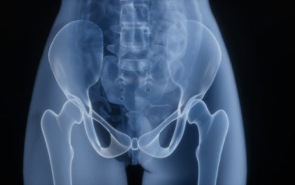 Where a femur breaks in a fall